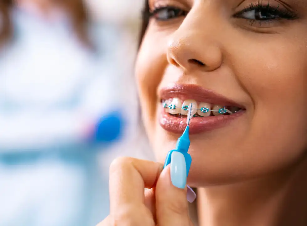 What Happens If You Lose Invisalign Braces Trays?